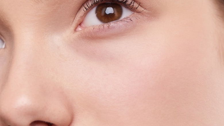 Everything to know about SkinPen treatment