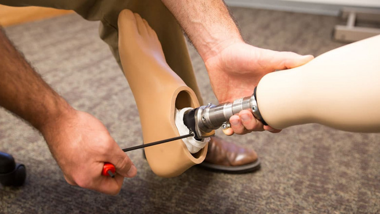 Orthopedic Prosthetics Market to Grow with an Impressive CAGR During the Forecast Period | TechSci Research