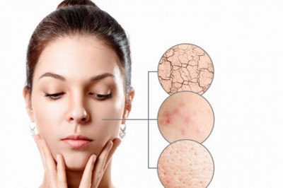 How Can A Skin Specialist in KL Help With Acne Scar Treatment?