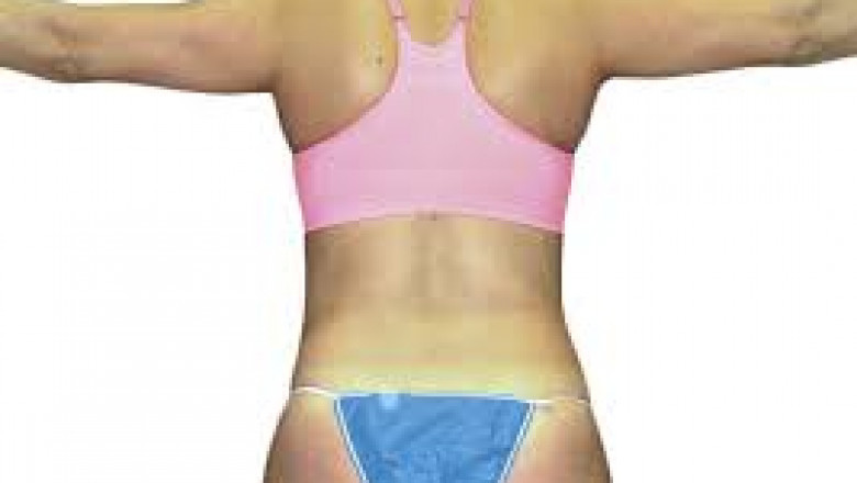 How to get Perfect Curves with Cosmetic Breast Surgery?
