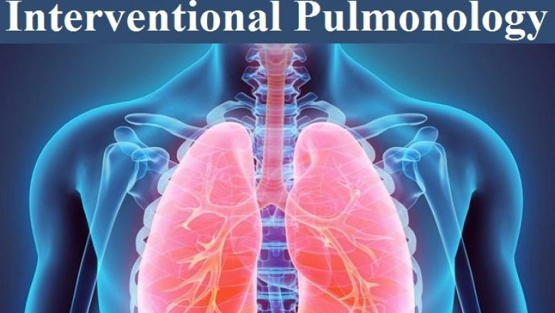 Interventional Pulmonology Market to Eyewitness Stunning Growth by 2026