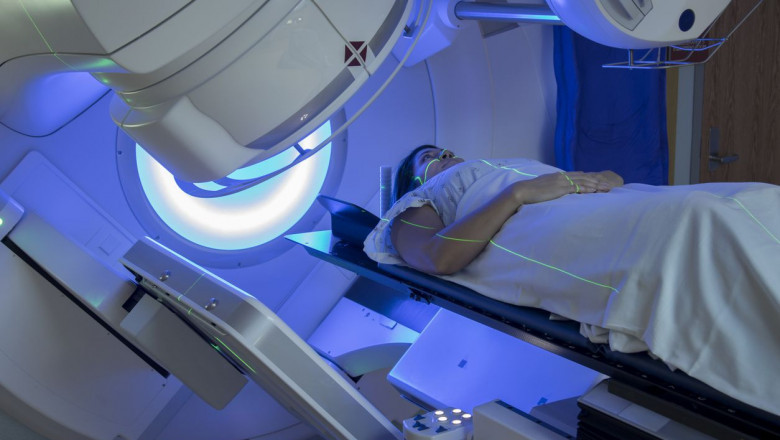 Radiotherapy Market Projected to Grow $7,222 Mn by 2023- What Factors Driving the Growth?