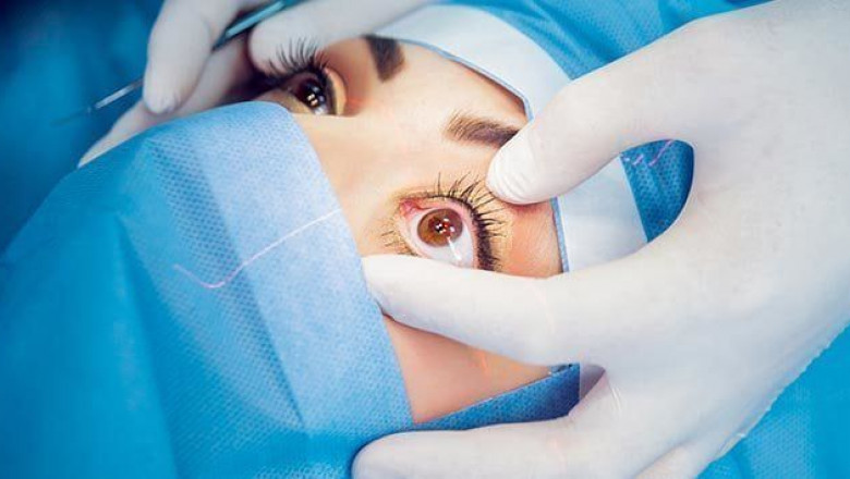Everything To Know About Cataract Surgery Devices