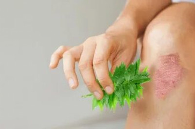 Eczema Therapeutics Market  Size, Current and Future | Research Informatic