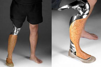 Global 3d Printed Medical Devices Market Analysis Report, 2018-2026