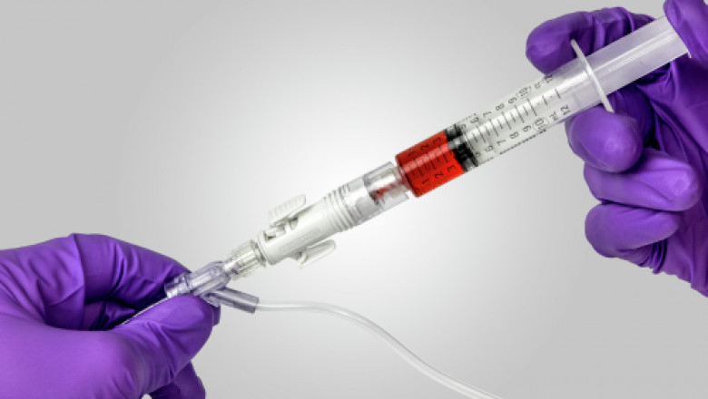 Closed System Transfer Devices Market 2021 Industry Outlook, Business Strategies, Trends and Forecast to 2028