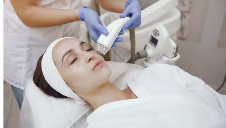 Why should you go for laser acne treatment in Las Vegas?