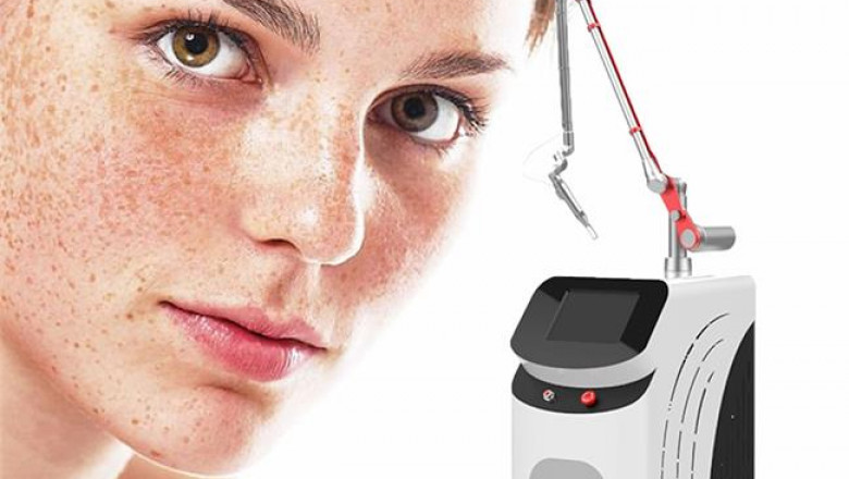 17 Things Every Person Should Know about Laser Tattoo Removal