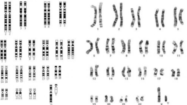 Karyotyping Market Regulations and Competitive Landscape Outlook 2021 to 2028