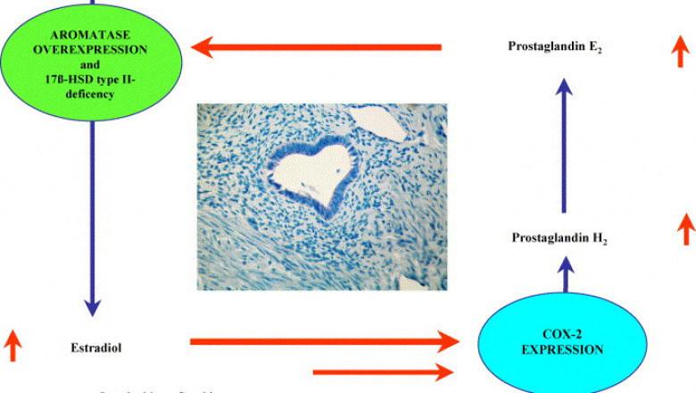 Cyclooxygenase 2 Inhibitor Market 2021 Industry Outlook, Present Scenario of Manufacturers, Channels Analysis and Forecast Research Study 2028
