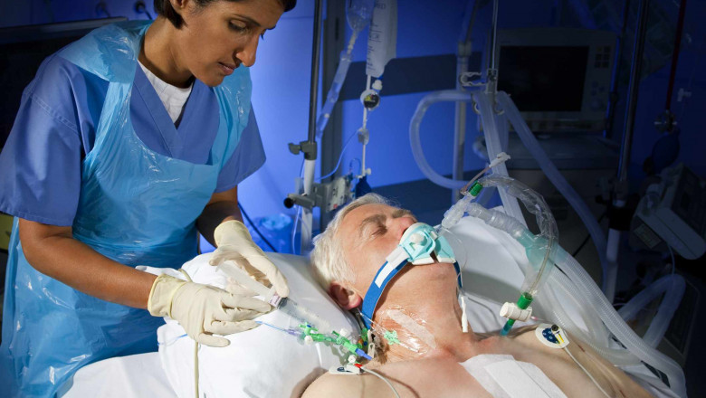 The Global "U.S. Central Venous Catheter Market" was growing at a CAGR of 5.4% during the forecast period ( 2021-2028).