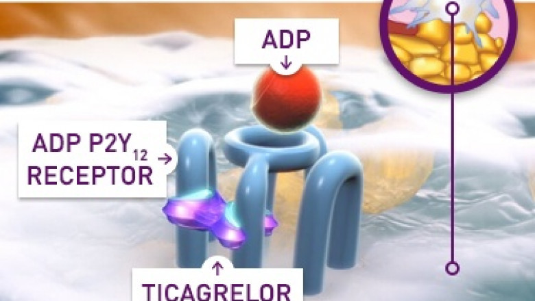 Ticagrelor Market Size Worth USD 2554.39 Million With 9% CAGR By 2027