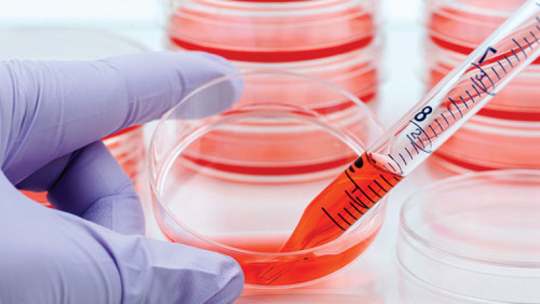 Cell Culture Market Segment Innovations Enhance the Overall Cell Culture Market