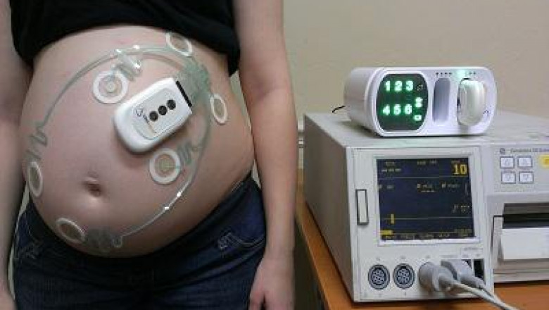 Intrapartum Monitoring Devices Market Growth Statistics, Driving Factors and Industry Growth Trends 2028