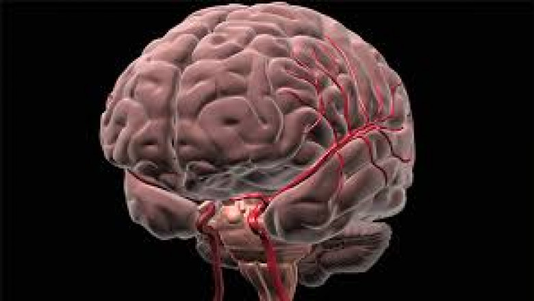 Global Brain Hemorrhage Treatment Market 2022 Outlook to 2027: Top Companies in Market, Trends and Growth Factors and Details for Business Development