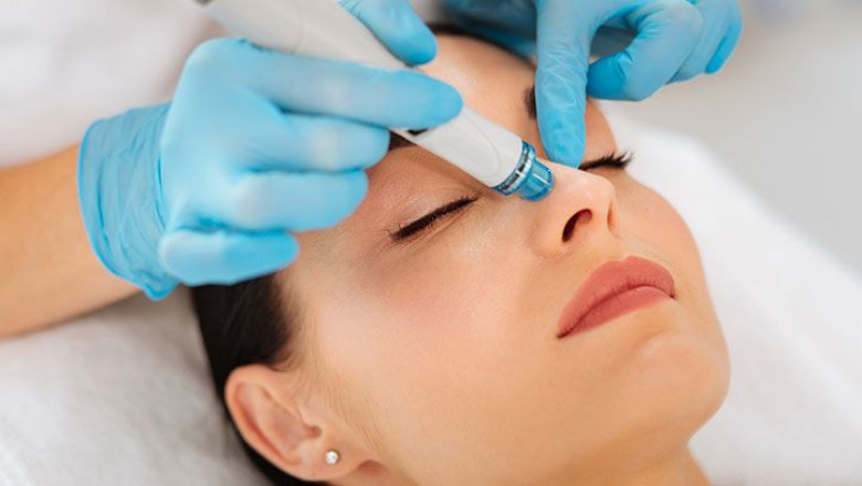 What Is The HydraFacial Treatment?