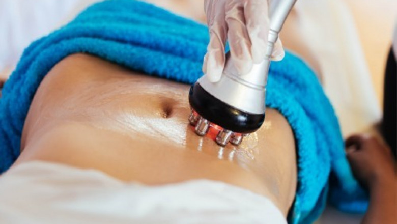 Cellulite: TOP 5 anti-cellulite treatment