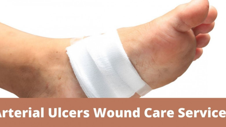 Arterial Ulcers Wound Care Services