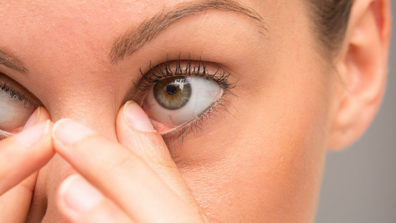 Overview and Regional Analysis of the Blepharitis Treatment Market