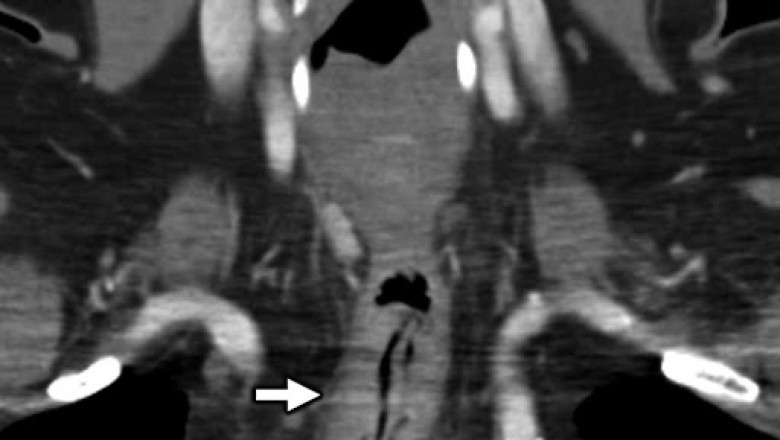 Secondary Otalgia Market 2021 Industry Research, Share, Trend, Price, Future Analysis, Regional Outlook to 2028