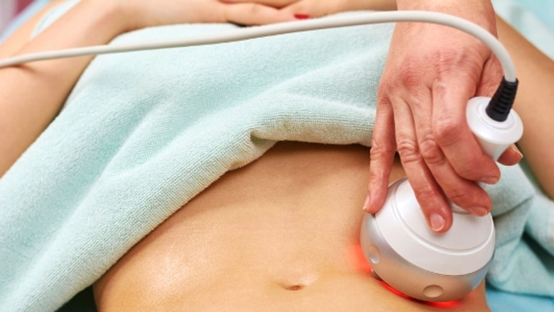 Star Beauty Combination: Cavitation and RF Lifting