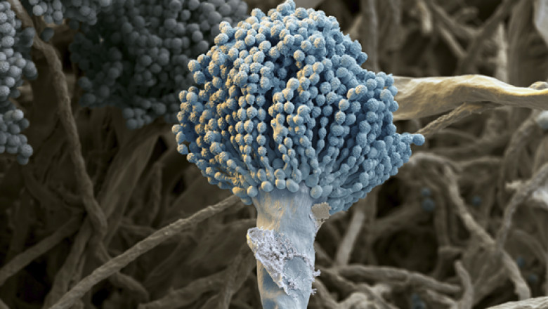 Trends in Aspergillosis Treatment Market