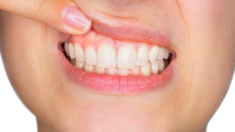 7 Things That Can Increase Your Risk of Gum Disease