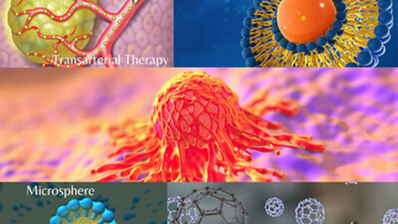 Drug delivery in cancer Market 2021 Industry Analysis by Top Leading Player, Key Regions, Future Demand and Forecast upto 2028