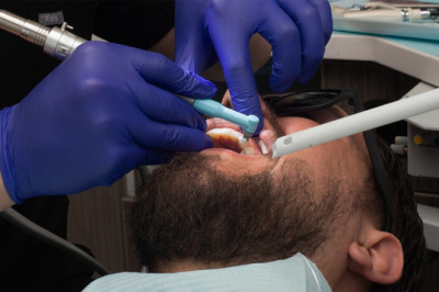 How To Stop Bleeding Gums?