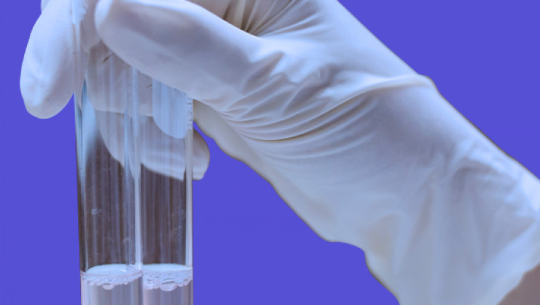 Acetic Acid Market Size, Share, Trends, Growth, Industry Report and Forecast 2030 - ChemAnalyst