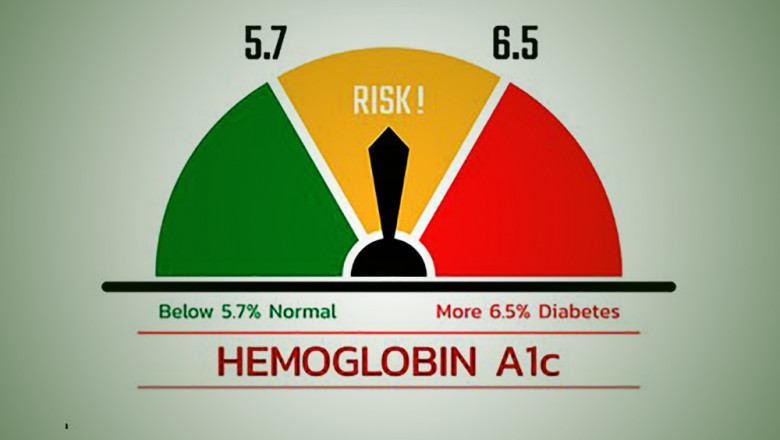 Hb A1 C in Agra - Meddco