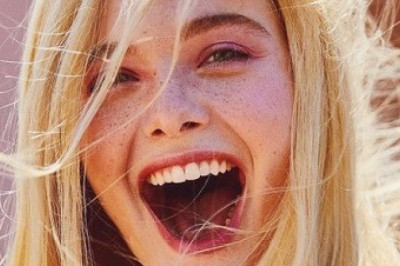 What Are Full Mouth Dental Implants ?