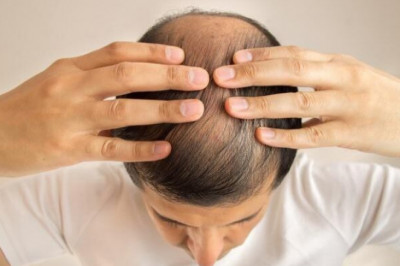 How To Get The Effective Hair Transplant in India?
