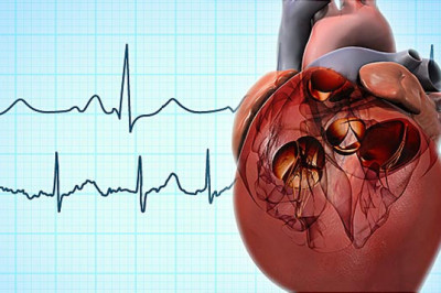 Causes of Atrial Fibrillation