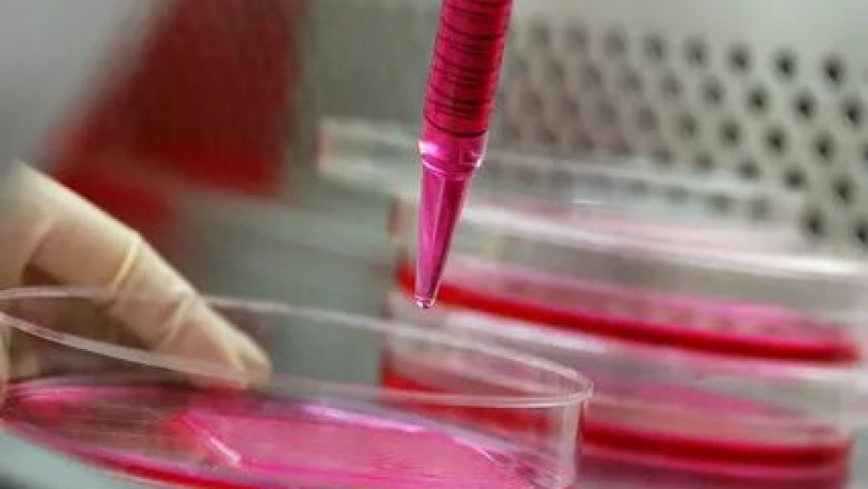 Cell Culture Vessels Market Sale 2021 Drivers and Application are Pertinent For Sustenance During Forecast up to 2026