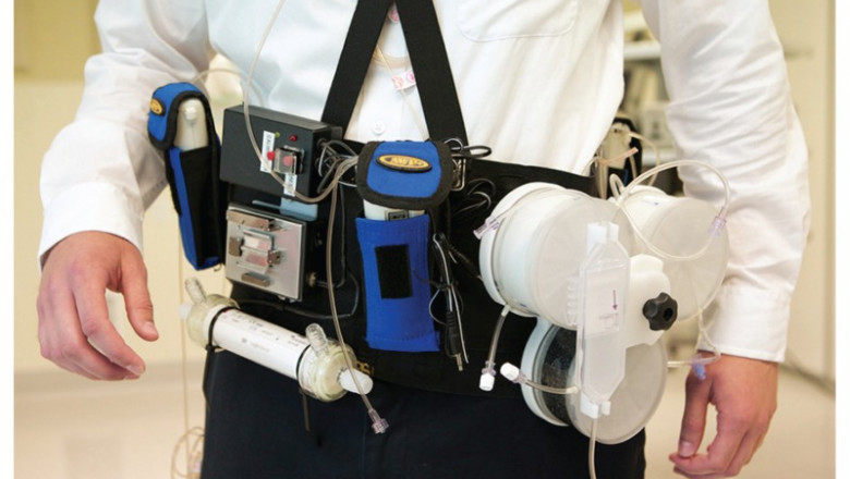 Portable and Wearable Dialysis Devices Market Driving Innovations, Future Growth and Industry Share Forecast to 2026