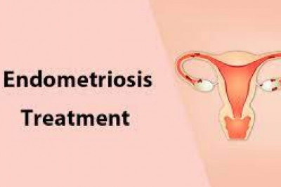 In The Global Endometriosis Treatment Market, Leading Industry Players Are Significantly Accelerating The Development Of Scientific And Clinical Therapeutic Agents