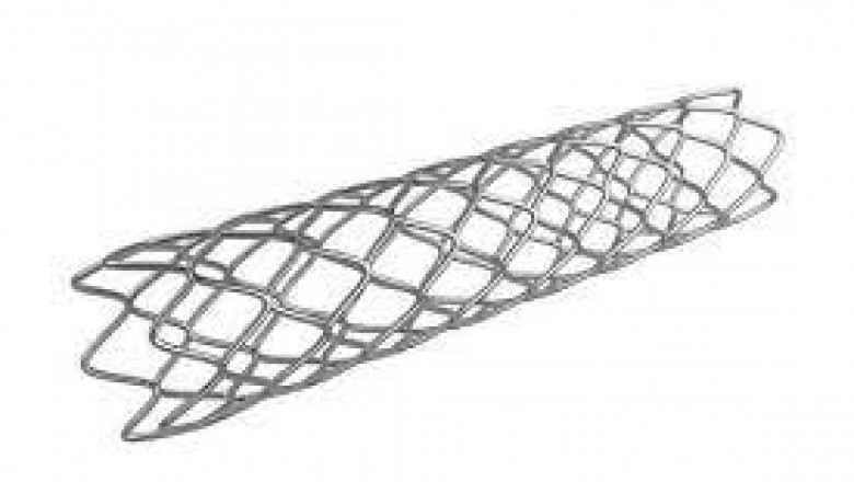 Non-Vascular Stent Market Analysis, Share, Size, Growth, Opportunity and Forecasts 2021-2026