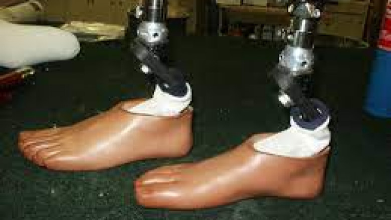 Prosthetic Foot Market Growth 2021- Revenue and Outlook, forecast to 2026