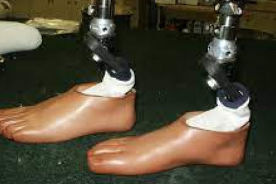 Prosthetic Foot Market Growth 2021- Revenue and Outlook, forecast to 2026