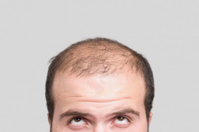 Regular Remedies To Stop Hair Fall