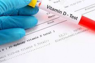 Vitamin D Testing Market Report Analysis, Industry Size And Growth 2026