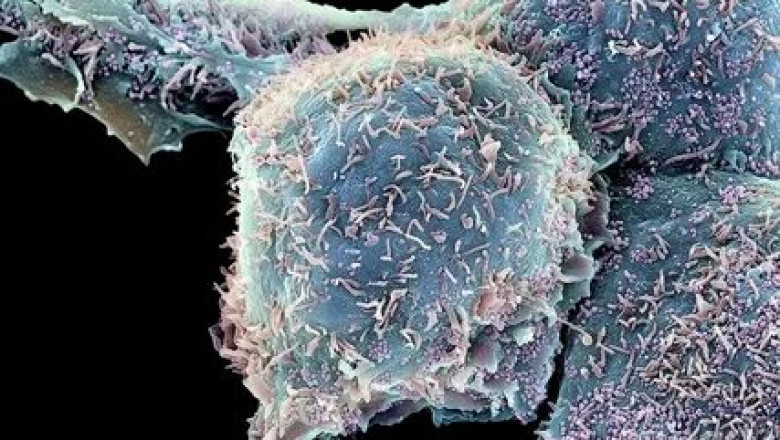 Drugs for Herpes Labialis (Oral Herpes) Market Huge Demand, Impact and Recovery Analysis and Significant Growth up to 2026