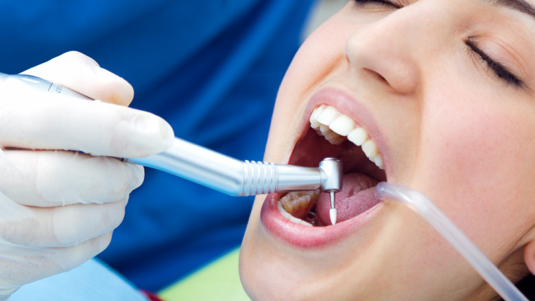 Are Dental Implants a Permanent Solution to Missing Teeth?