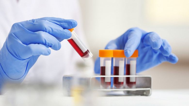 Global Biomarkers Market Definition