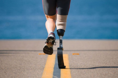 Prosthetic finger and scoliosis brace: How they can be useful to lead a normal life?