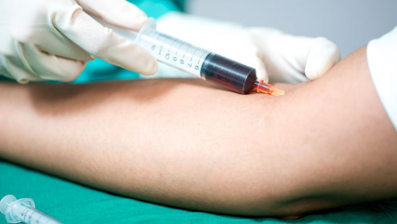Bloodstream Infection Testing Market 2021 Recent Development, Covid-19 Effect Analysis by Top Companies and Forecast 2028