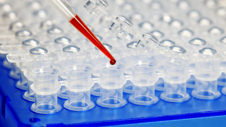 Global Polymerase Chain Reaction (PCR) Market Forecast