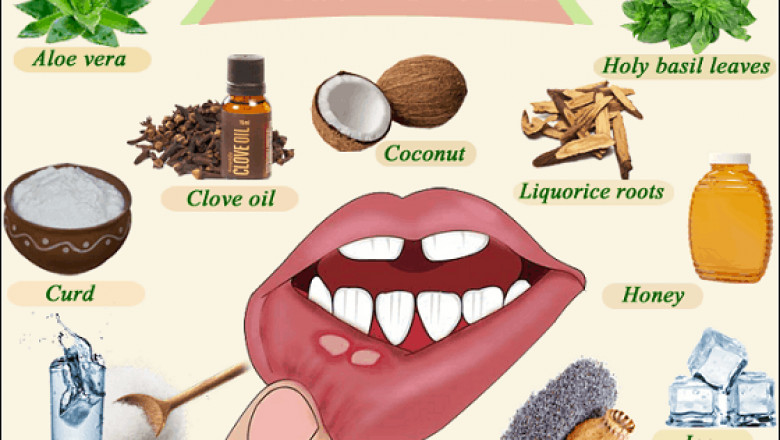 Mouth Ulcers