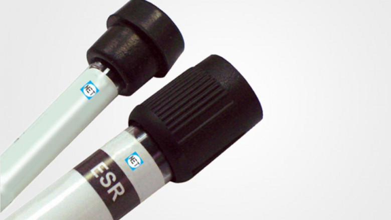 What is a normal ESR Tubes level?